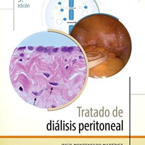Tratado de diálisis peritoneal (3ª ed.) (Spanish Edition) (Original PDF from Publisher)