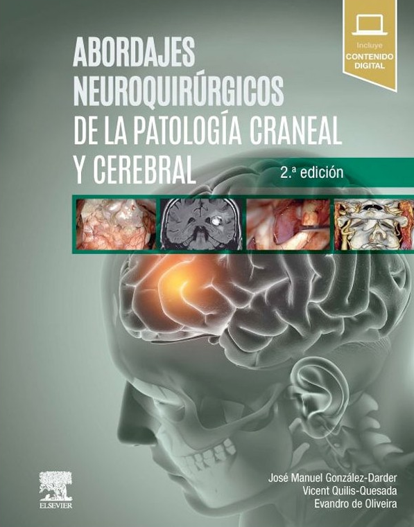 Abordajes neuroquirúrgicos de la patología craneal y cerebral, 2.ª edición (True PDF)