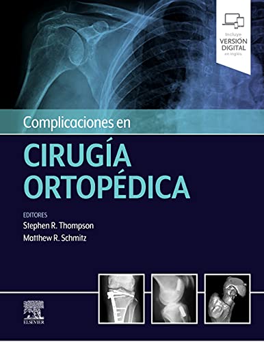 Complicaciones en cirugía ortopédica: Medicina deportiva (Original PDF from Publisher)