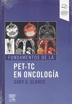 Fundamentos de la PET-TC en oncología (Spanish Edition) (True PDF)
