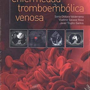 Compendio de enfermedad tromboembólica venosa (Spanish Edition) (Original PDF from Publisher)