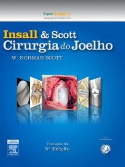 Insall & Scott Cirurgia do Joelho