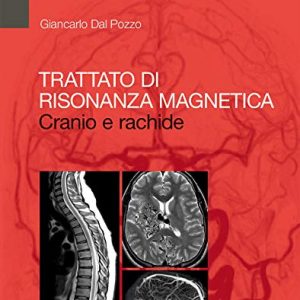 Trattato di Risonanza Magnetica: Cranio e rachide (Italian Edition) (EPUB)