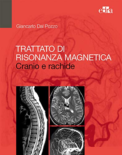 Trattato di Risonanza Magnetica: Cranio e rachide (Italian Edition) (EPUB)