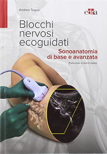 Blocchi nervosi ecoguidati. Sonoanatomia di base avanzata (EPUB)
