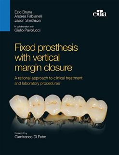 Fixed prosthesis with vertical margin closure. A rational approach to clinical treatment and laboratory procedures (ePub)