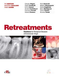Retreatment. Solutions for apical diseases of endodontic origin (EPUB)