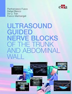 Ultrasound-guided nerve blocks of the trunk and abdominal wall (ePub+Converted PDF)