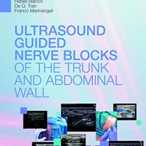 Ultrasound-guided nerve blocks of the trunk and abdominal wall (ePub+Converted PDF)