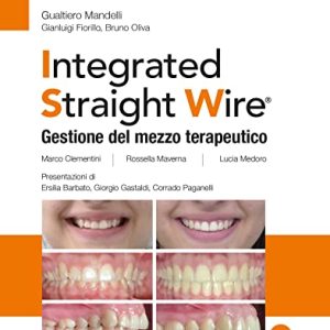 Integrated straight wire. Gestione del mezzo terapeutico (EPUB)