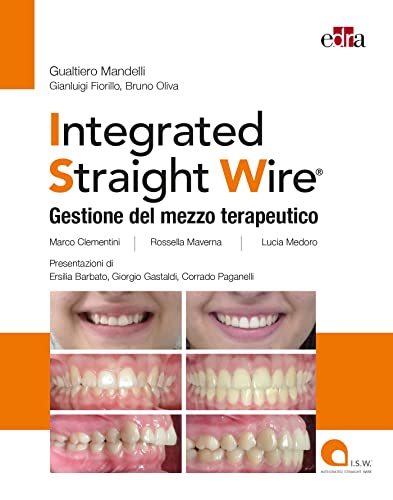 Integrated straight wire. Gestione del mezzo terapeutico (EPUB)