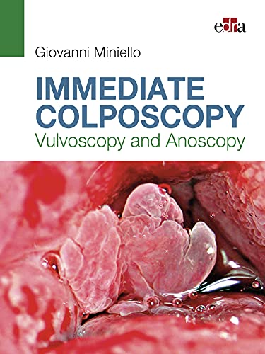 Immediate Colposcopy – Vulvoscopy and Anoscopy (EPUB+Converted PDF)