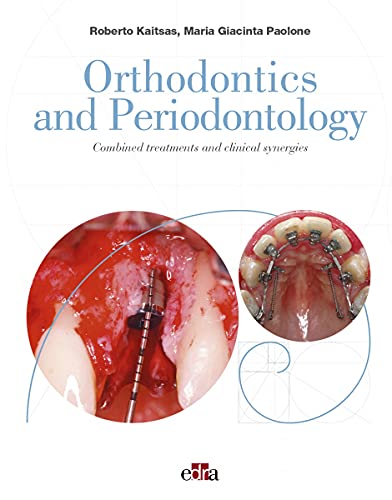 Orthodontics and Periodontology: Combined treatments and clinical synergies (azw3+epub+Converted PDF)