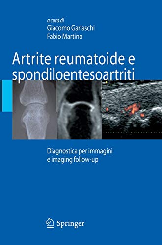 Artrite reumatoide e spondiloentesoartriti: Diagnostica Per Immagini Ed Imaging Follow-Up (Original PDF from Publisher)