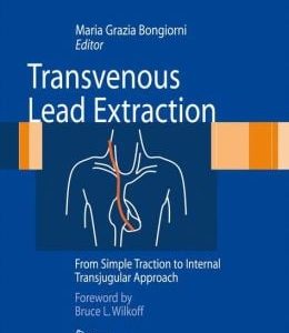 Transvenous Lead Extraction: From Simple Traction to Internal Transjugular Approach (EPUB)