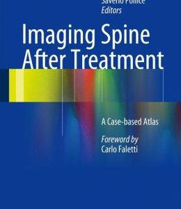 Imaging Spine After Treatment: A Case-based Atlas