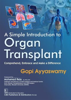 A Simple Introduction to Organ Transplant (Original PDF from Publisher)