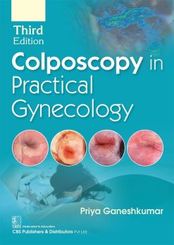 Colposcopy in Practical Gynecology, 3rd Edition (Original PDF from Publisher)