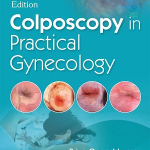 Colposcopy in Practical Gynecology, 3rd Edition (Original PDF from Publisher)