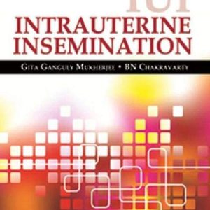 IUI Intrauterine Insemination (Original PDF from Publisher)