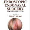 Functional Endoscopic Sinus Surgery