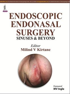 Functional Endoscopic Sinus Surgery