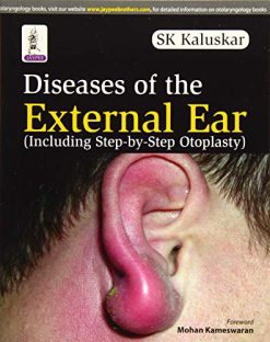 Diseases Of The External Ear (Including Step-By-Step Otoplasty) (Original PDF from Publisher)