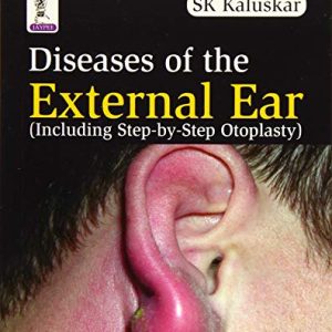 Diseases Of The External Ear (Including Step-By-Step Otoplasty) (Original PDF from Publisher)