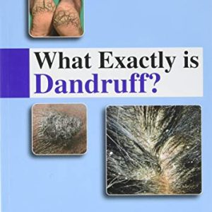What Exactly is Dandruff (Original PDF from Publisher)