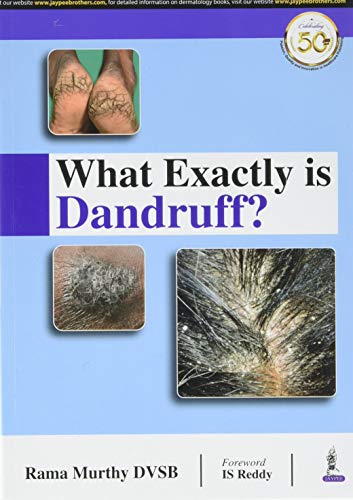 What Exactly is Dandruff (Original PDF from Publisher)