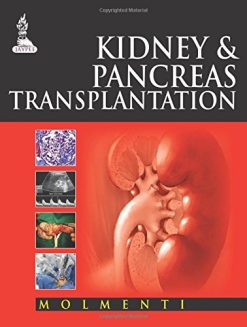 Kidney and Pancreas Transplantation (Original PDF from Publisher)