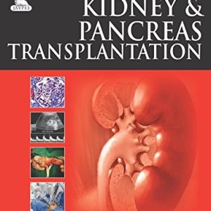 Kidney and Pancreas Transplantation (Original PDF from Publisher)