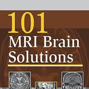 101 MRI Brain Solutions
