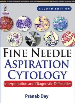 Fine Needle Aspiration Cytology: Interpretation and Diagnostic Difficulties, 2nd Edition (Original PDF from Publisher)