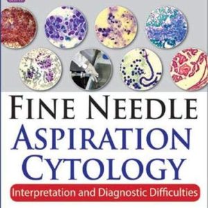 Fine Needle Aspiration Cytology: Interpretation and Diagnostic Difficulties, 2nd Edition (Original PDF from Publisher)