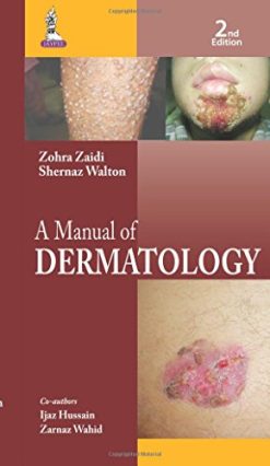 A Manual of Dermatology, 2nd Edition (Original PDF from Publisher)