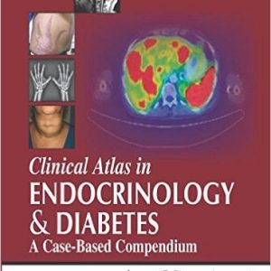 Clinical Atlas in Endocrinology and Diabetes: A Case-Based Compendium (PDF)