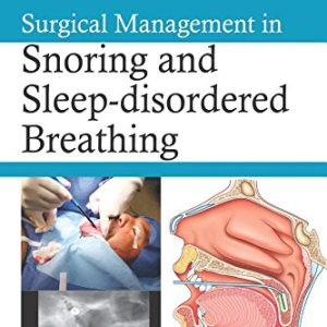Surgical Management in Snoring and Sleep-disordered Breathing