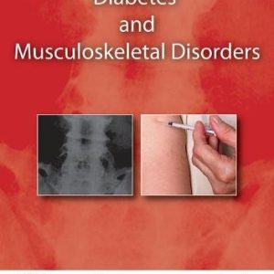 Diabetes and Musculoskeletal Disorders (Original PDF from Publisher)
