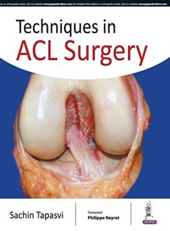 Techniques in ACL Surgery (Original PDF from Publisher)