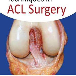 Techniques in ACL Surgery (Original PDF from Publisher)