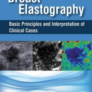 Breast Elastography: Basic Principles and Interpretation of Clinical Cases (Original PDF from Publisher)