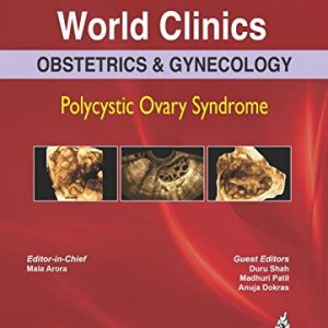 World Clinics: Obstetrics & Gynecology: Polycystic Ovary Syndrome (Original PDF from Publisher)