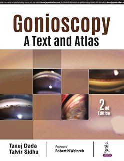 Gonioscopy: A Text and Atlas, 2nd Edition (Original PDF from Publisher)
