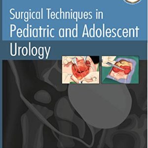 Surgical Techniques in Pediatric and Adolescent Urology (Converted PDF)
