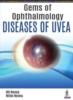 Gems of Ophthalmology-Diseases of Uvea (Original PDF from Publisher)