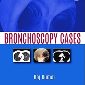 Bronchoscopy Cases (Original PDF from Publisher)