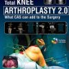 Total Knee Arthroplasty 2.0: What CAS can add to the Surgery (Original PDF from Publisher)