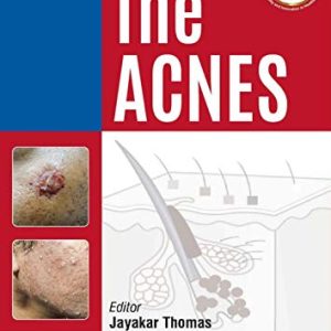 The Acnes (Original PDF from Publisher)
