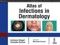 Atlas of Infections in Dermatology (Original PDF from Publisher)